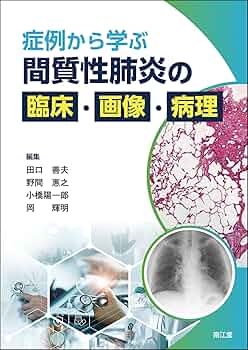 画像から学ぶびまん性肺疾患 Amazon.co.jp: 画像から学ぶびまん性肺疾患 : 酒井 文和: 本